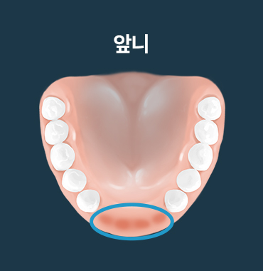 앞니