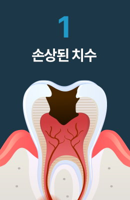 손상된 치수