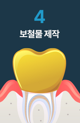 보철물 제작